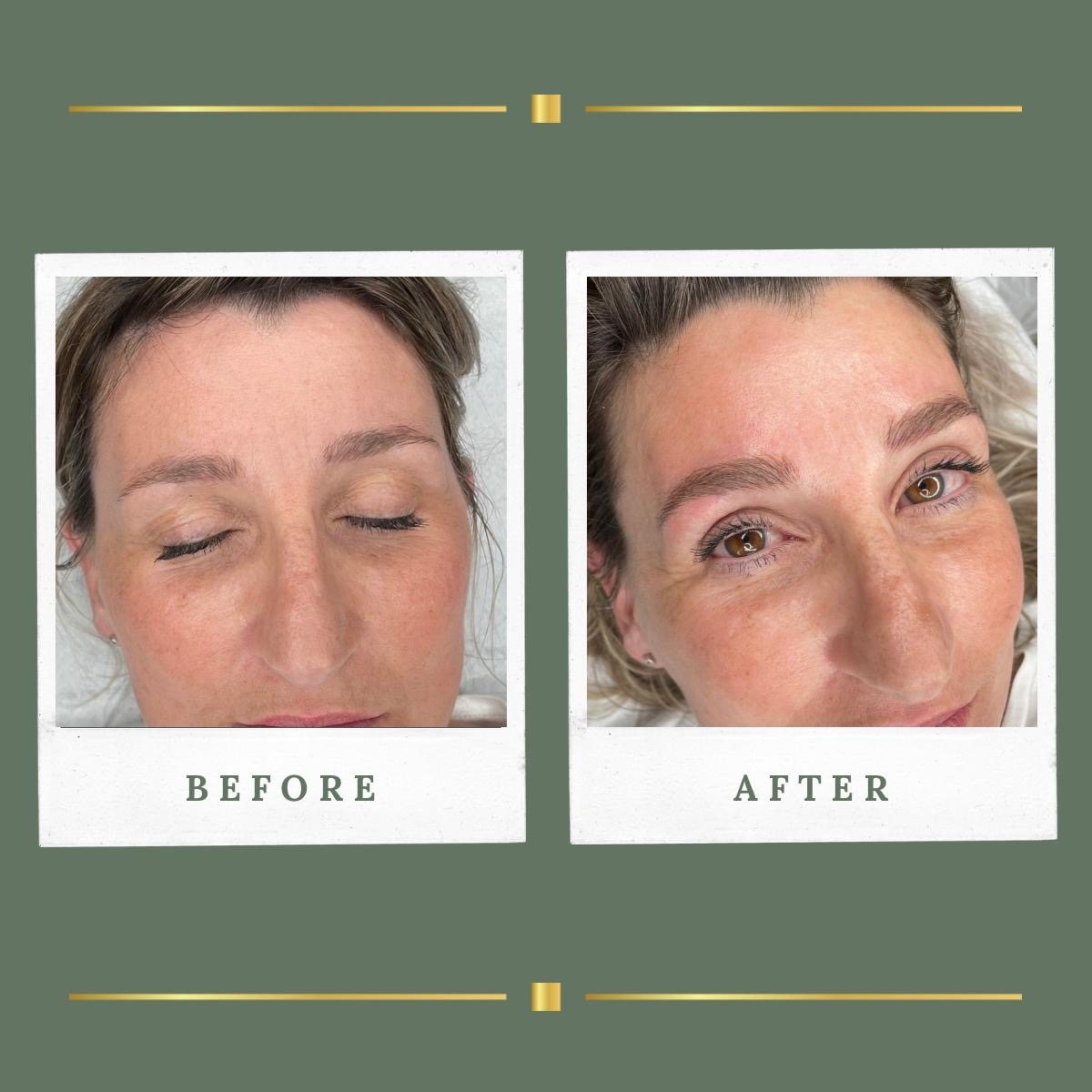 Before and after Nannobrows permanent makeup result at Rachel Aesthetics, Farnsfield